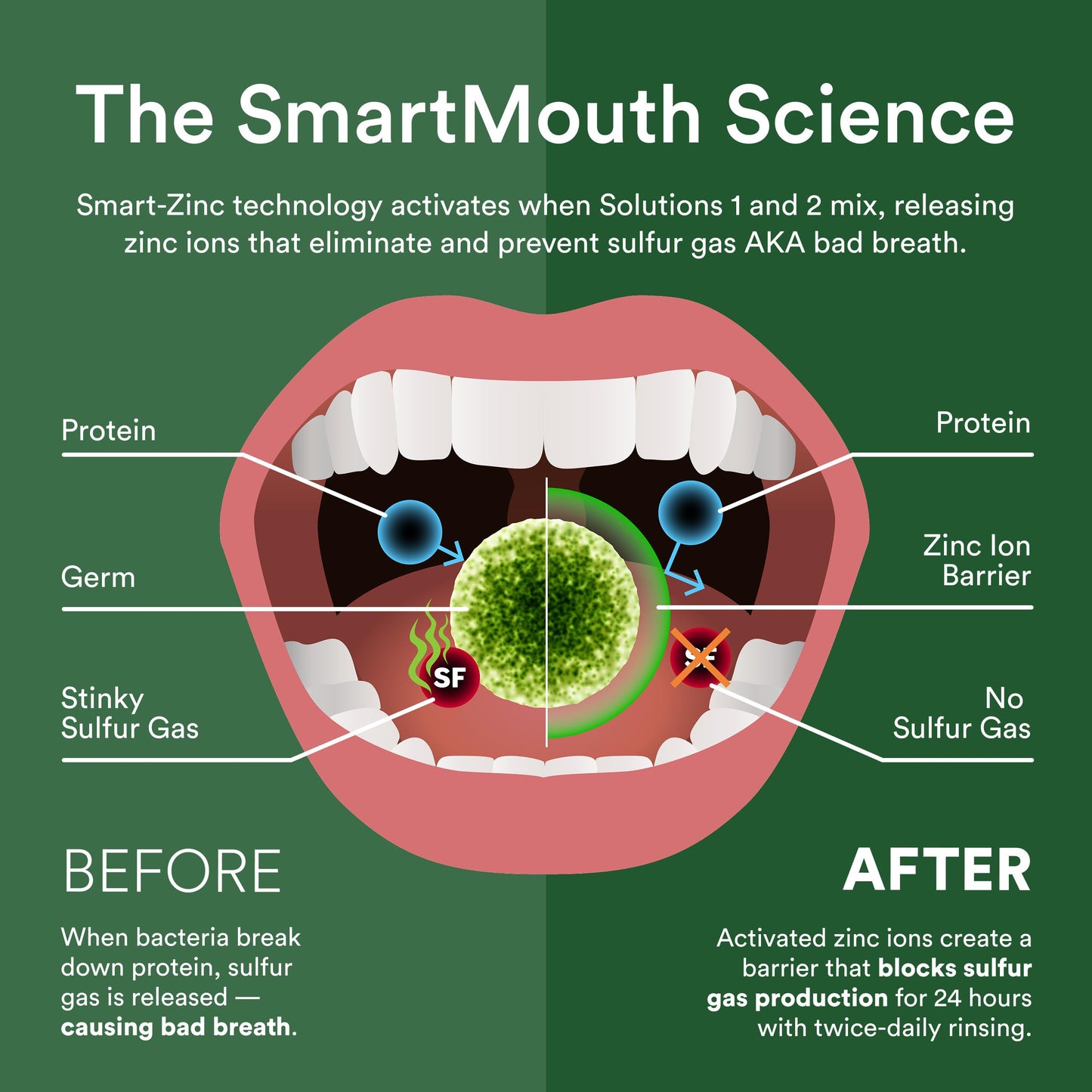 SmartMouth DDS Activated Clinical Mouthwash with Tongue Cleaner – Fresh Breath, Gum Health, 16 oz