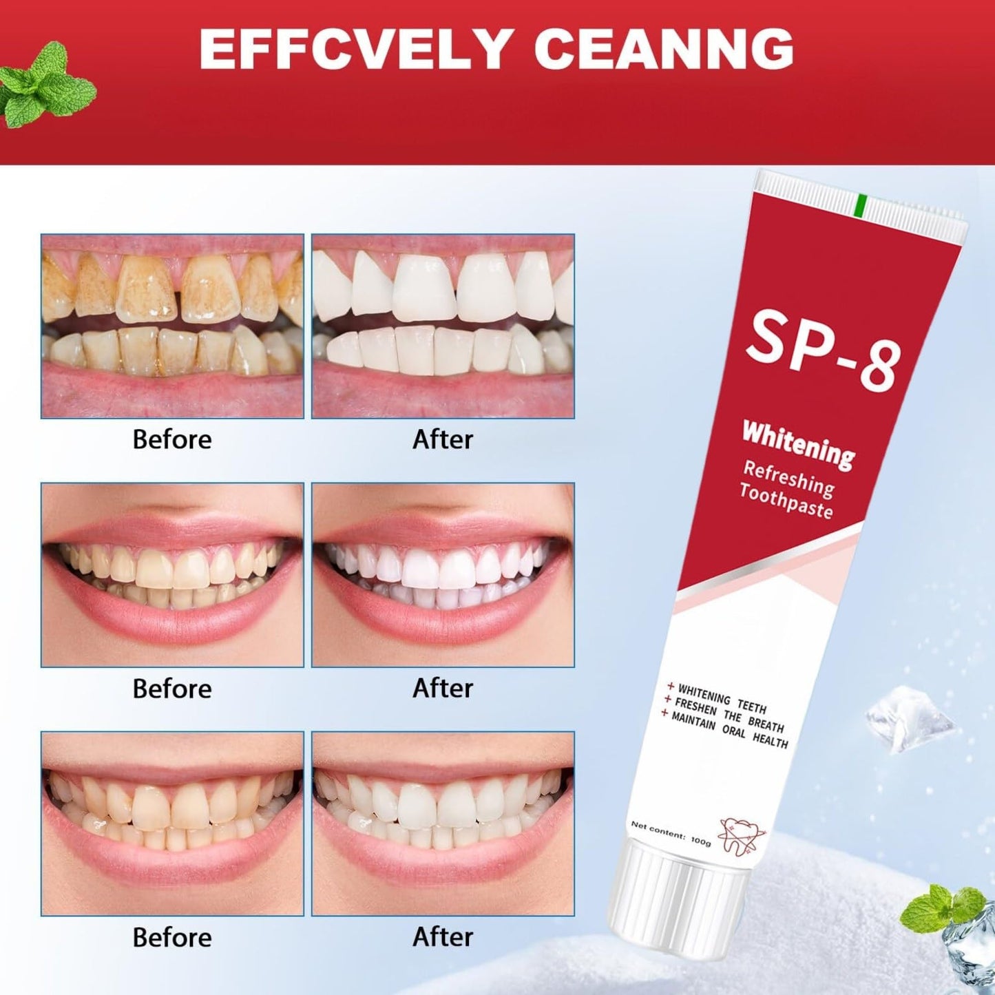 SP-8 Probiotic Toothpaste - Fresh Breath & Deep Cleaning (100g)