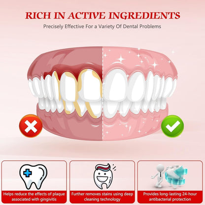 SP-6 Probiotic Whitening Toothpaste – Fluoride Free, Mint, Sensitive Teeth