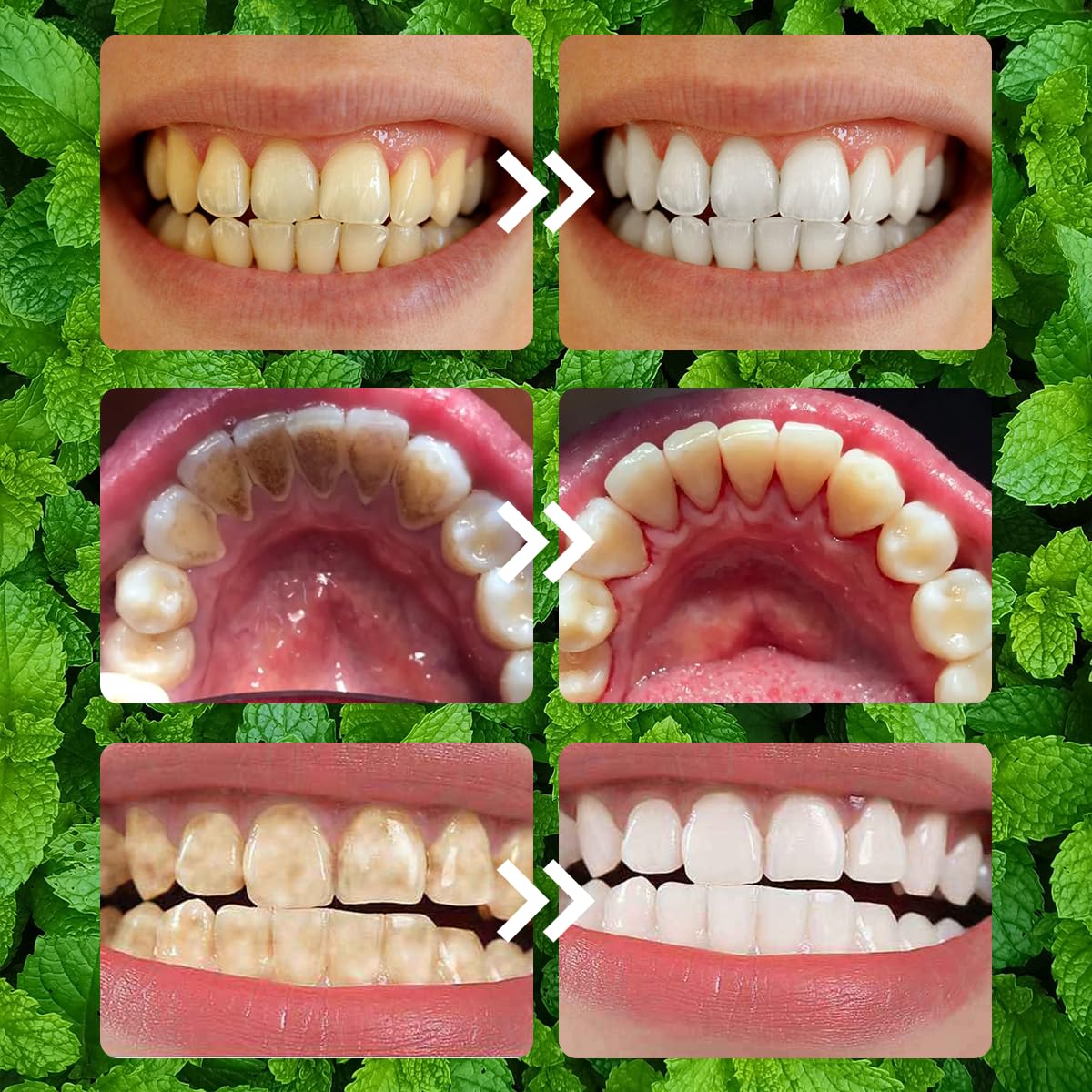 Teeth Restoration Mineral Powder - Strengthen Teeth & Gums | Oral Care Mineral Powder