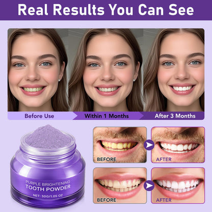 Teeth Whitening Powder - No Sensitivity & Stain Removal Booster