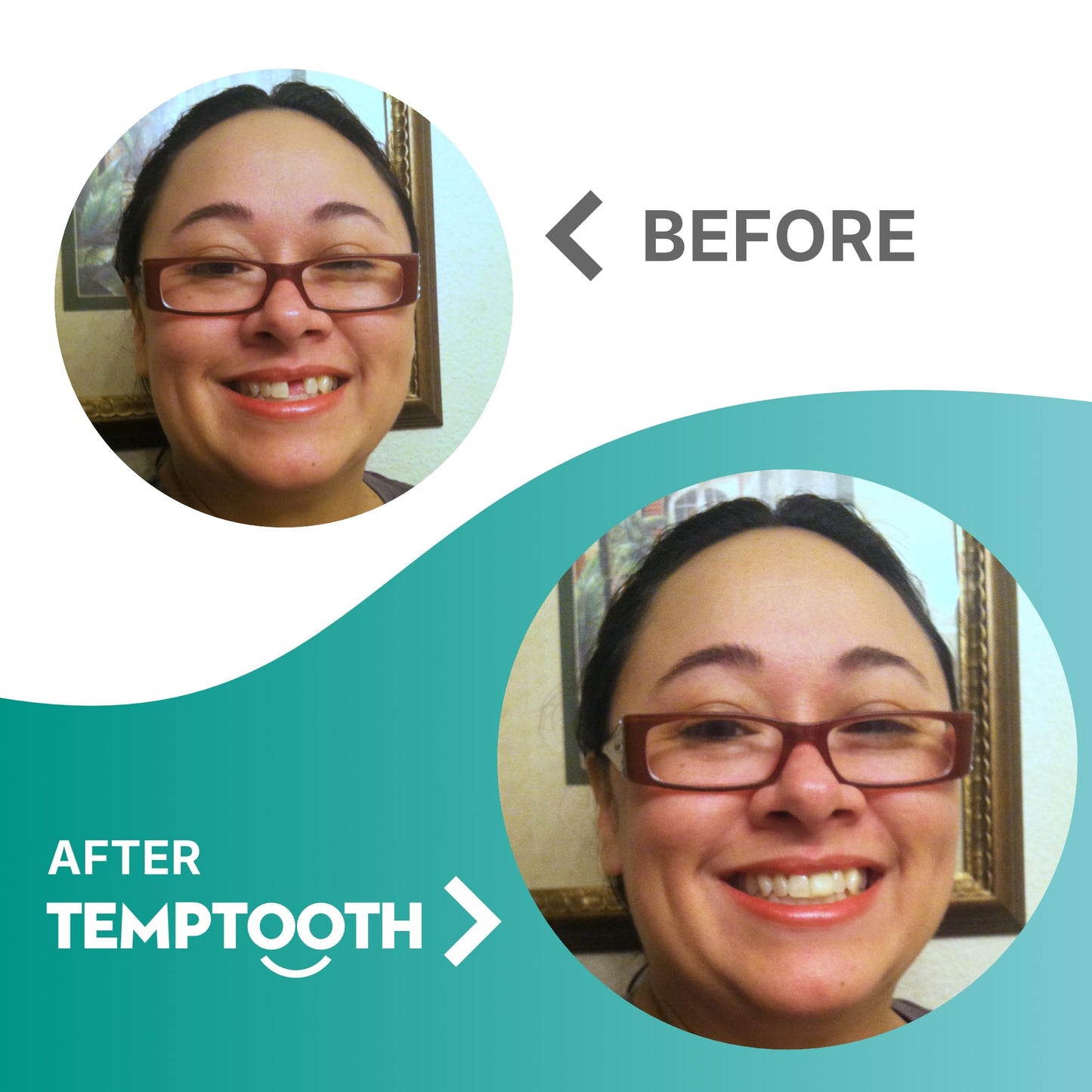 Temptooth Tooth Replacement Product with Coloring Material - Easy Shade Matching