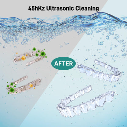 Ultrasonic Retainer Cleaner with UV Light - 45kHz Cleaning Pod (Black)