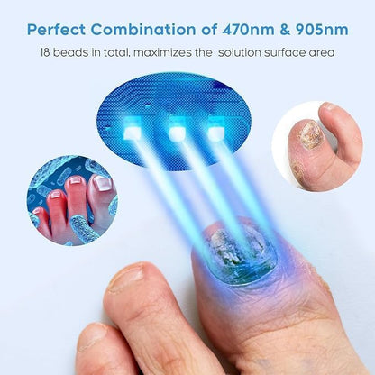 ZZP Toenail Fungus Device – White, Multi-Nail Home Light Therapy